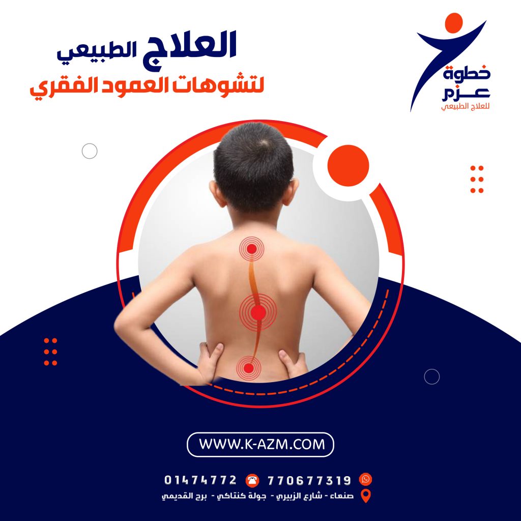 علاج طبيعي للعمود الفقري في صنعاء ، اليمن علاج طبيعي لتشوهات العمود الفقري في صنعاء ، اليمن تقويم العمود الفقري في صنعاء ، اليمن جلسات علاج طبيعي للعمود الفقري في صنعاء ، اليمن علاج طبيعي للعمود الفقري في صنعاء ، اليمن علاج طبيعي لتشوهات العمود الفقري في صنعاء ، اليمن تقويم العمود الفقري في صنعاء ، اليمن جلسات علاج طبيعي للعمود الفقري في صنعاء ، اليمن علاج طبيعي للعمود الفقري في صنعاء ، اليمن علاج طبيعي لتشوهات العمود الفقري في صنعاء ، اليمن تقويم العمود الفقري في صنعاء ، اليمن جلسات علاج طبيعي للعمود الفقري في صنعاء ، اليمن علاج طبيعي للعمود الفقري في صنعاء ، اليمن علاج طبيعي لتشوهات العمود الفقري في صنعاء ، اليمن تقويم العمود الفقري في صنعاء ، اليمن جلسات علاج طبيعي للعمود الفقري في صنعاء ، اليمن علاج طبيعي للعمود الفقري في صنعاء ، اليمن علاج طبيعي لتشوهات العمود الفقري في صنعاء ، اليمن تقويم العمود الفقري في صنعاء ، اليمن جلسات علاج طبيعي للعمود الفقري في صنعاء ، اليمن علاج طبيعي للعمود الفقري في صنعاء ، اليمن علاج طبيعي لتشوهات العمود الفقري في صنعاء ، اليمن تقويم العمود الفقري في صنعاء ، اليمن جلسات علاج طبيعي للعمود الفقري في صنعاء ، اليمن علاج طبيعي للعمود الفقري في صنعاء ، اليمن علاج طبيعي لتشوهات العمود الفقري في صنعاء ، اليمن تقويم العمود الفقري في صنعاء ، اليمن جلسات علاج طبيعي للعمود الفقري في صنعاء ، اليمن علاج طبيعي للعمود الفقري في صنعاء ، اليمن علاج طبيعي لتشوهات العمود الفقري في صنعاء ، اليمن تقويم العمود الفقري في صنعاء ، اليمن جلسات علاج طبيعي للعمود الفقري في صنعاء ، اليمن علاج طبيعي للعمود الفقري في صنعاء ، اليمن علاج طبيعي لتشوهات العمود الفقري في صنعاء ، اليمن تقويم العمود الفقري في صنعاء ، اليمن جلسات علاج طبيعي للعمود الفقري في صنعاء ، اليمن علاج طبيعي للعمود الفقري في صنعاء ، اليمن علاج طبيعي لتشوهات العمود الفقري في صنعاء ، اليمن تقويم العمود الفقري في صنعاء ، اليمن جلسات علاج طبيعي للعمود الفقري في صنعاء ، اليمن علاج طبيعي للعمود الفقري في صنعاء ، اليمن علاج طبيعي لتشوهات العمود الفقري في صنعاء ، اليمن تقويم العمود الفقري في صنعاء ، اليمن جلسات علاج طبيعي للعمود الفقري في صنعاء ، اليمن علاج طبيعي للعمود الفقري في صنعاء ، اليمن علاج طبيعي لتشوهات العمود الفقري في صنعاء ، اليمن تقويم العمود الفقري في صنعاء ، اليمن جلسات علاج طبيعي للعمود الفقري في صنعاء ، اليمن علاج طبيعي للعمود الفقري في صنعاء ، اليمن علاج طبيعي لتشوهات العمود الفقري في صنعاء ، اليمن تقويم العمود الفقري في صنعاء ، اليمن جلسات علاج طبيعي للعمود الفقري في صنعاء ، اليمن علاج طبيعي للعمود الفقري في صنعاء ، اليمن علاج طبيعي لتشوهات العمود الفقري في صنعاء ، اليمن تقويم العمود الفقري في صنعاء ، اليمن جلسات علاج طبيعي للعمود الفقري في صنعاء ، اليمن علاج طبيعي للعمود الفقري في صنعاء ، اليمن علاج طبيعي لتشوهات العمود الفقري في صنعاء ، اليمن تقويم العمود الفقري في صنعاء ، اليمن جلسات علاج طبيعي للعمود الفقري في صنعاء ، اليمن علاج طبيعي للعمود الفقري في صنعاء ، اليمن علاج طبيعي لتشوهات العمود الفقري في صنعاء ، اليمن تقويم العمود الفقري في صنعاء ، اليمن جلسات علاج طبيعي للعمود الفقري في صنعاء ، اليمن علاج طبيعي للعمود الفقري في صنعاء ، اليمن علاج طبيعي لتشوهات العمود الفقري في صنعاء ، اليمن تقويم العمود الفقري في صنعاء ، اليمن جلسات علاج طبيعي للعمود الفقري في صنعاء ، اليمن علاج طبيعي للعمود الفقري في صنعاء ، اليمن علاج طبيعي لتشوهات العمود الفقري في صنعاء ، اليمن تقويم العمود الفقري في صنعاء ، اليمن جلسات علاج طبيعي للعمود الفقري في صنعاء ، اليمن علاج طبيعي للعمود الفقري في صنعاء ، اليمن علاج طبيعي لتشوهات العمود الفقري في صنعاء ، اليمن تقويم العمود الفقري في صنعاء ، اليمن جلسات علاج طبيعي للعمود الفقري في صنعاء ، اليمن علاج طبيعي للعمود الفقري في صنعاء ، اليمن علاج طبيعي لتشوهات العمود الفقري في صنعاء ، اليمن تقويم العمود الفقري في صنعاء ، اليمن جلسات علاج طبيعي للعمود الفقري في صنعاء ، اليمن علاج طبيعي للعمود الفقري في صنعاء ، اليمن علاج طبيعي لتشوهات العمود الفقري في صنعاء ، اليمن تقويم العمود الفقري في صنعاء ، اليمن جلسات علاج طبيعي للعمود الفقري في صنعاء ، اليمن علاج طبيعي للعمود الفقري في صنعاء ، اليمن علاج طبيعي لتشوهات العمود الفقري في صنعاء ، اليمن تقويم العمود الفقري في صنعاء ، اليمن جلسات علاج طبيعي للعمود الفقري في صنعاء ، اليمن علاج طبيعي للعمود الفقري في صنعاء ، اليمن علاج طبيعي لتشوهات العمود الفقري في صنعاء ، اليمن تقويم العمود الفقري في صنعاء ، اليمن جلسات علاج طبيعي للعمود الفقري في صنعاء ، اليمن علاج طبيعي للعمود الفقري في صنعاء ، اليمن علاج طبيعي لتشوهات العمود الفقري في صنعاء ، اليمن تقويم العمود الفقري في صنعاء ، اليمن جلسات علاج طبيعي للعمود الفقري في صنعاء ، اليمن علاج طبيعي للعمود الفقري في صنعاء ، اليمن علاج طبيعي لتشوهات العمود الفقري في صنعاء ، اليمن تقويم العمود الفقري في صنعاء ، اليمن جلسات علاج طبيعي للعمود الفقري في صنعاء ، اليمن علاج طبيعي للعمود الفقري في صنعاء ، اليمن علاج طبيعي لتشوهات العمود الفقري في صنعاء ، اليمن تقويم العمود الفقري في صنعاء ، اليمن جلسات علاج طبيعي للعمود الفقري في صنعاء ، اليمن علاج طبيعي للعمود الفقري في صنعاء ، اليمن علاج طبيعي لتشوهات العمود الفقري في صنعاء ، اليمن تقويم العمود الفقري في صنعاء ، اليمن جلسات علاج طبيعي للعمود الفقري في صنعاء ، اليمن علاج طبيعي للعمود الفقري في صنعاء ، اليمن علاج طبيعي لتشوهات العمود الفقري في صنعاء ، اليمن تقويم العمود الفقري في صنعاء ، اليمن جلسات علاج طبيعي للعمود الفقري في صنعاء ، اليمن علاج طبيعي للعمود الفقري في صنعاء ، اليمن علاج طبيعي لتشوهات العمود الفقري في صنعاء ، اليمن تقويم العمود الفقري في صنعاء ، اليمن جلسات علاج طبيعي للعمود الفقري في صنعاء ، اليمن علاج طبيعي للعمود الفقري في صنعاء ، اليمن علاج طبيعي لتشوهات العمود الفقري في صنعاء ، اليمن تقويم العمود الفقري في صنعاء ، اليمن جلسات علاج طبيعي للعمود الفقري في صنعاء ، اليمن علاج طبيعي للعمود الفقري في صنعاء ، اليمن علاج طبيعي لتشوهات العمود الفقري في صنعاء ، اليمن تقويم العمود الفقري في صنعاء ، اليمن جلسات علاج طبيعي للعمود الفقري في صنعاء ، اليمن علاج طبيعي للعمود الفقري في صنعاء ، اليمن علاج طبيعي لتشوهات العمود الفقري في صنعاء ، اليمن تقويم العمود الفقري في صنعاء ، اليمن جلسات علاج طبيعي للعمود الفقري في صنعاء ، اليمن علاج طبيعي للعمود الفقري في صنعاء ، اليمن علاج طبيعي لتشوهات العمود الفقري في صنعاء ، اليمن تقويم العمود الفقري في صنعاء ، اليمن جلسات علاج طبيعي للعمود الفقري في صنعاء ، اليمن علاج طبيعي للعمود الفقري في صنعاء ، اليمن علاج طبيعي لتشوهات العمود الفقري في صنعاء ، اليمن تقويم العمود الفقري في صنعاء ، اليمن جلسات علاج طبيعي للعمود الفقري في صنعاء ، اليمن علاج طبيعي للعمود الفقري في صنعاء ، اليمن علاج طبيعي لتشوهات العمود الفقري في صنعاء ، اليمن تقويم العمود الفقري في صنعاء ، اليمن جلسات علاج طبيعي للعمود الفقري في صنعاء ، اليمن علاج طبيعي للعمود الفقري في صنعاء ، اليمن علاج طبيعي لتشوهات العمود الفقري في صنعاء ، اليمن تقويم العمود الفقري في صنعاء ، اليمن جلسات علاج طبيعي للعمود الفقري في صنعاء ، اليمن علاج طبيعي للعمود الفقري في صنعاء ، اليمن علاج طبيعي لتشوهات العمود الفقري في صنعاء ، اليمن تقويم العمود الفقري في صنعاء ، اليمن جلسات علاج طبيعي للعمود الفقري في صنعاء ، اليمن علاج طبيعي للعمود الفقري في صنعاء ، اليمن علاج طبيعي لتشوهات العمود الفقري في صنعاء ، اليمن تقويم العمود الفقري في صنعاء ، اليمن جلسات علاج طبيعي للعمود الفقري في صنعاء ، اليمن علاج طبيعي للعمود الفقري في صنعاء ، اليمن علاج طبيعي لتشوهات العمود الفقري في صنعاء ، اليمن تقويم العمود الفقري في صنعاء ، اليمن جلسات علاج طبيعي للعمود الفقري في صنعاء ، اليمن علاج طبيعي للعمود الفقري في صنعاء ، اليمن علاج طبيعي لتشوهات العمود الفقري في صنعاء ، اليمن تقويم العمود الفقري في صنعاء ، اليمن جلسات علاج طبيعي للعمود الفقري في صنعاء ، اليمن علاج طبيعي للعمود الفقري في صنعاء ، اليمن علاج طبيعي لتشوهات العمود الفقري في صنعاء ، اليمن تقويم العمود الفقري في صنعاء ، اليمن جلسات علاج طبيعي للعمود الفقري في صنعاء ، اليمن علاج طبيعي للعمود الفقري في صنعاء ، اليمن علاج طبيعي لتشوهات العمود الفقري في صنعاء ، اليمن تقويم العمود الفقري في صنعاء ، اليمن جلسات علاج طبيعي للعمود الفقري في صنعاء ، اليمن علاج طبيعي للعمود الفقري في صنعاء ، اليمن علاج طبيعي لتشوهات العمود الفقري في صنعاء ، اليمن تقويم العمود الفقري في صنعاء ، اليمن جلسات علاج طبيعي للعمود الفقري في صنعاء ، اليمن علاج طبيعي للعمود الفقري في صنعاء ، اليمن علاج طبيعي لتشوهات العمود الفقري في صنعاء ، اليمن تقويم العمود الفقري في صنعاء ، اليمن جلسات علاج طبيعي للعمود الفقري في صنعاء ، اليمن علاج طبيعي للعمود الفقري في صنعاء ، اليمن علاج طبيعي لتشوهات العمود الفقري في صنعاء ، اليمن تقويم العمود الفقري في صنعاء ، اليمن جلسات علاج طبيعي للعمود الفقري في صنعاء ، اليمن علاج طبيعي للعمود الفقري في صنعاء ، اليمن علاج طبيعي لتشوهات العمود الفقري في صنعاء ، اليمن تقويم العمود الفقري في صنعاء ، اليمن جلسات علاج طبيعي للعمود الفقري في صنعاء ، اليمن علاج طبيعي للعمود الفقري في صنعاء ، اليمن علاج طبيعي لتشوهات العمود الفقري في صنعاء ، اليمن تقويم العمود الفقري في صنعاء ، اليمن جلسات علاج طبيعي للعمود الفقري في صنعاء ، اليمن علاج طبيعي للعمود الفقري في صنعاء ، اليمن علاج طبيعي لتشوهات العمود الفقري في صنعاء ، اليمن تقويم العمود الفقري في صنعاء ، اليمن جلسات علاج طبيعي للعمود الفقري في صنعاء ، اليمن علاج طبيعي للعمود الفقري في صنعاء ، اليمن علاج طبيعي لتشوهات العمود الفقري في صنعاء ، اليمن تقويم العمود الفقري في صنعاء ، اليمن جلسات علاج طبيعي للعمود الفقري في صنعاء ، اليمن علاج طبيعي للعمود الفقري في صنعاء ، اليمن علاج طبيعي لتشوهات العمود الفقري في صنعاء ، اليمن تقويم العمود الفقري في صنعاء ، اليمن جلسات علاج طبيعي للعمود الفقري في صنعاء ، اليمن علاج طبيعي للعمود الفقري في صنعاء ، اليمن علاج طبيعي لتشوهات العمود الفقري في صنعاء ، اليمن تقويم العمود الفقري في صنعاء ، اليمن جلسات علاج طبيعي للعمود الفقري في صنعاء ، اليمن علاج طبيعي للعمود الفقري في صنعاء ، اليمن علاج طبيعي لتشوهات العمود الفقري في صنعاء ، اليمن تقويم العمود الفقري في صنعاء ، اليمن جلسات علاج طبيعي للعمود الفقري في صنعاء ، اليمن علاج طبيعي للعمود الفقري في صنعاء ، اليمن علاج طبيعي لتشوهات العمود الفقري في صنعاء ، اليمن تقويم العمود الفقري في صنعاء ، اليمن جلسات علاج طبيعي للعمود الفقري في صنعاء ، اليمن علاج طبيعي للعمود الفقري في صنعاء ، اليمن علاج طبيعي لتشوهات العمود الفقري في صنعاء ، اليمن تقويم العمود الفقري في صنعاء ، اليمن جلسات علاج طبيعي للعمود الفقري في صنعاء ، اليمن علاج طبيعي للعمود الفقري في صنعاء ، اليمن علاج طبيعي لتشوهات العمود الفقري في صنعاء ، اليمن تقويم العمود الفقري في صنعاء ، اليمن جلسات علاج طبيعي للعمود الفقري في صنعاء ، اليمن علاج طبيعي للعمود الفقري في صنعاء ، اليمن علاج طبيعي لتشوهات العمود الفقري في صنعاء ، اليمن تقويم العمود الفقري في صنعاء ، اليمن جلسات علاج طبيعي للعمود الفقري في صنعاء ، اليمن علاج طبيعي للعمود الفقري في صنعاء ، اليمن علاج طبيعي لتشوهات العمود الفقري في صنعاء ، اليمن تقويم العمود الفقري في صنعاء ، اليمن جلسات علاج طبيعي للعمود الفقري في صنعاء ، اليمن علاج طبيعي للعمود الفقري في صنعاء ، اليمن علاج طبيعي لتشوهات العمود الفقري في صنعاء ، اليمن تقويم العمود الفقري في صنعاء ، اليمن جلسات علاج طبيعي للعمود الفقري في صنعاء ، اليمن علاج طبيعي للعمود الفقري في صنعاء ، اليمن علاج طبيعي لتشوهات العمود الفقري في صنعاء ، اليمن تقويم العمود الفقري في صنعاء ، اليمن جلسات علاج طبيعي للعمود الفقري في صنعاء ، اليمن علاج طبيعي للعمود الفقري في صنعاء ، اليمن علاج طبيعي لتشوهات العمود الفقري في صنعاء ، اليمن تقويم العمود الفقري في صنعاء ، اليمن جلسات علاج طبيعي للعمود الفقري في صنعاء ، اليمن علاج طبيعي للعمود الفقري في صنعاء ، اليمن علاج طبيعي لتشوهات العمود الفقري في صنعاء ، اليمن تقويم العمود الفقري في صنعاء ، اليمن جلسات علاج طبيعي للعمود الفقري في صنعاء ، اليمن علاج طبيعي للعمود الفقري في صنعاء ، اليمن علاج طبيعي لتشوهات العمود الفقري في صنعاء ، اليمن تقويم العمود الفقري في صنعاء ، اليمن جلسات علاج طبيعي للعمود الفقري في صنعاء ، اليمن علاج طبيعي للعمود الفقري في صنعاء ، اليمن علاج طبيعي لتشوهات العمود الفقري في صنعاء ، اليمن تقويم العمود الفقري في صنعاء ، اليمن جلسات علاج طبيعي للعمود الفقري في صنعاء ، اليمن علاج طبيعي للعمود الفقري في صنعاء ، اليمن علاج طبيعي لتشوهات العمود الفقري في صنعاء ، اليمن تقويم العمود الفقري في صنعاء ، اليمن جلسات علاج طبيعي للعمود الفقري في صنعاء ، اليمن علاج طبيعي للعمود الفقري في صنعاء ، اليمن علاج طبيعي لتشوهات العمود الفقري في صنعاء ، اليمن تقويم العمود الفقري في صنعاء ، اليمن جلسات علاج طبيعي للعمود الفقري في صنعاء ، اليمن علاج طبيعي للعمود الفقري في صنعاء ، اليمن علاج طبيعي لتشوهات العمود الفقري في صنعاء ، اليمن تقويم العمود الفقري في صنعاء ، اليمن جلسات علاج طبيعي للعمود الفقري في صنعاء ، اليمن علاج طبيعي للعمود الفقري في صنعاء ، اليمن علاج طبيعي لتشوهات العمود الفقري في صنعاء ، اليمن تقويم العمود الفقري في صنعاء ، اليمن جلسات علاج طبيعي للعمود الفقري في صنعاء ، اليمن علاج طبيعي للعمود الفقري في صنعاء ، اليمن علاج طبيعي لتشوهات العمود الفقري في صنعاء ، اليمن تقويم العمود الفقري في صنعاء ، اليمن جلسات علاج طبيعي للعمود الفقري في صنعاء ، اليمن علاج طبيعي للعمود الفقري في صنعاء ، اليمن علاج طبيعي لتشوهات العمود الفقري في صنعاء ، اليمن تقويم العمود الفقري في صنعاء ، اليمن جلسات علاج طبيعي للعمود الفقري في صنعاء ، اليمن علاج طبيعي للعمود الفقري في صنعاء ، اليمن علاج طبيعي لتشوهات العمود الفقري في صنعاء ، اليمن تقويم العمود الفقري في صنعاء ، اليمن جلسات علاج طبيعي للعمود الفقري في صنعاء ، اليمن علاج طبيعي للعمود الفقري في صنعاء ، اليمن علاج طبيعي لتشوهات العمود الفقري في صنعاء ، اليمن تقويم العمود الفقري في صنعاء ، اليمن جلسات علاج طبيعي للعمود الفقري في صنعاء ، اليمن علاج طبيعي للعمود الفقري في صنعاء ، اليمن علاج طبيعي لتشوهات العمود الفقري في صنعاء ، اليمن تقويم العمود الفقري في صنعاء ، اليمن جلسات علاج طبيعي للعمود الفقري في صنعاء ، اليمن علاج طبيعي للعمود الفقري في صنعاء ، اليمن علاج طبيعي لتشوهات العمود الفقري في صنعاء ، اليمن تقويم العمود الفقري في صنعاء ، اليمن جلسات علاج طبيعي للعمود الفقري في صنعاء ، اليمن علاج طبيعي للعمود الفقري في صنعاء ، اليمن علاج طبيعي لتشوهات العمود الفقري في صنعاء ، اليمن تقويم العمود الفقري في صنعاء ، اليمن جلسات علاج طبيعي للعمود الفقري في صنعاء ، اليمن علاج طبيعي للعمود الفقري في صنعاء ، اليمن علاج طبيعي لتشوهات العمود الفقري في صنعاء ، اليمن تقويم العمود الفقري في صنعاء ، اليمن جلسات علاج طبيعي للعمود الفقري في صنعاء ، اليمن علاج طبيعي للعمود الفقري في صنعاء ، اليمن علاج طبيعي لتشوهات العمود الفقري في صنعاء ، اليمن تقويم العمود الفقري في صنعاء ، اليمن جلسات علاج طبيعي للعمود الفقري في صنعاء ، اليمن علاج طبيعي للعمود الفقري في صنعاء ، اليمن علاج طبيعي لتشوهات العمود الفقري في صنعاء ، اليمن تقويم العمود الفقري في صنعاء ، اليمن جلسات علاج طبيعي للعمود الفقري في صنعاء ، اليمن علاج طبيعي للعمود الفقري في صنعاء ، اليمن علاج طبيعي لتشوهات العمود الفقري في صنعاء ، اليمن تقويم العمود الفقري في صنعاء ، اليمن جلسات علاج طبيعي للعمود الفقري في صنعاء ، اليمن علاج طبيعي للعمود الفقري في صنعاء ، اليمن علاج طبيعي لتشوهات العمود الفقري في صنعاء ، اليمن تقويم العمود الفقري في صنعاء ، اليمن جلسات علاج طبيعي للعمود الفقري في صنعاء ، اليمن علاج طبيعي للعمود الفقري في صنعاء ، اليمن علاج طبيعي لتشوهات العمود الفقري في صنعاء ، اليمن تقويم العمود الفقري في صنعاء ، اليمن جلسات علاج طبيعي للعمود الفقري في صنعاء ، اليمن علاج طبيعي للعمود الفقري في صنعاء ، اليمن علاج طبيعي لتشوهات العمود الفقري في صنعاء ، اليمن تقويم العمود الفقري في صنعاء ، اليمن جلسات علاج طبيعي للعمود الفقري في صنعاء ، اليمن علاج طبيعي للعمود الفقري في صنعاء ، اليمن علاج طبيعي لتشوهات العمود الفقري في صنعاء ، اليمن تقويم العمود الفقري في صنعاء ، اليمن جلسات علاج طبيعي للعمود الفقري في صنعاء ، اليمن علاج طبيعي للعمود الفقري في صنعاء ، اليمن علاج طبيعي لتشوهات العمود الفقري في صنعاء ، اليمن تقويم العمود الفقري في صنعاء ، اليمن جلسات علاج طبيعي للعمود الفقري في صنعاء ، اليمن علاج طبيعي للعمود الفقري في صنعاء ، اليمن علاج طبيعي لتشوهات العمود الفقري في صنعاء ، اليمن تقويم العمود الفقري في صنعاء ، اليمن جلسات علاج طبيعي للعمود الفقري في صنعاء ، اليمن